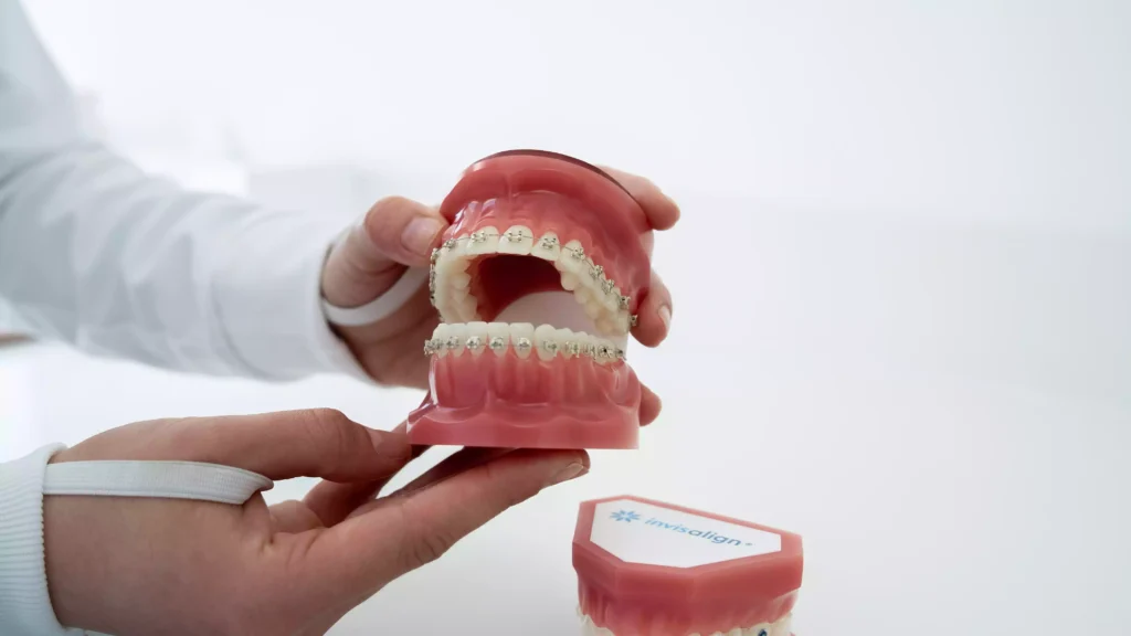 A person holds a dental model with braces attached to the teeth; another dental model labeled "Invisalign" is on the table.