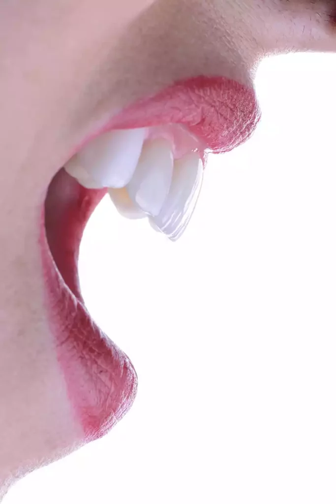 A close up of a woman's mouth highlighting her teeth after cosmetic dentistry.