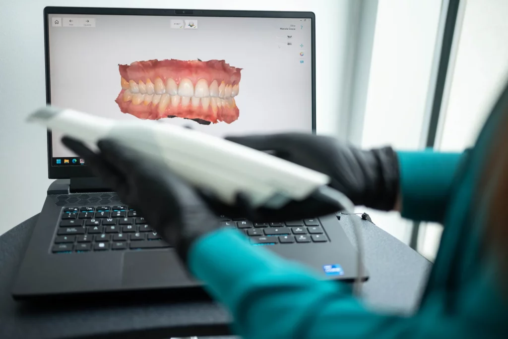 A woman is using a laptop to display a dental model created through Digital Smile Design.