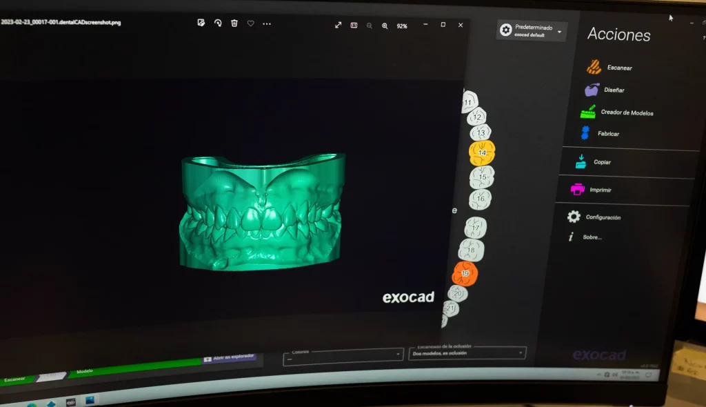 A computer screen displaying a Digital Smile Design of a tooth in 3D.