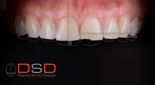 Dsd dental design specializes in Smile Design.
