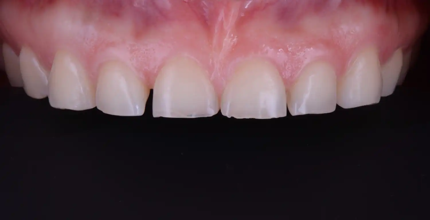 A gallery showcasing close-ups of patients' teeth.