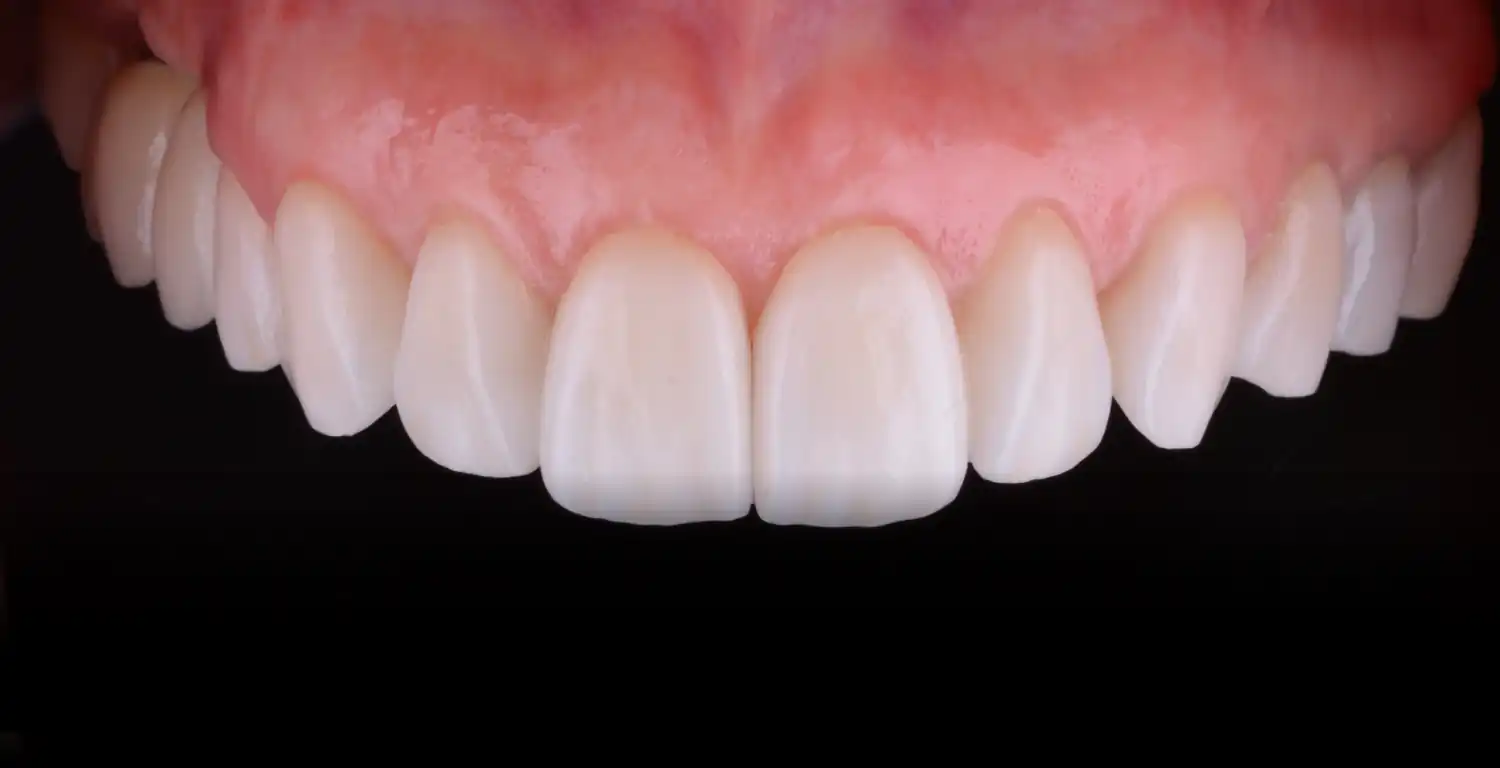 A gallery showcasing close-up shots of white teeth.