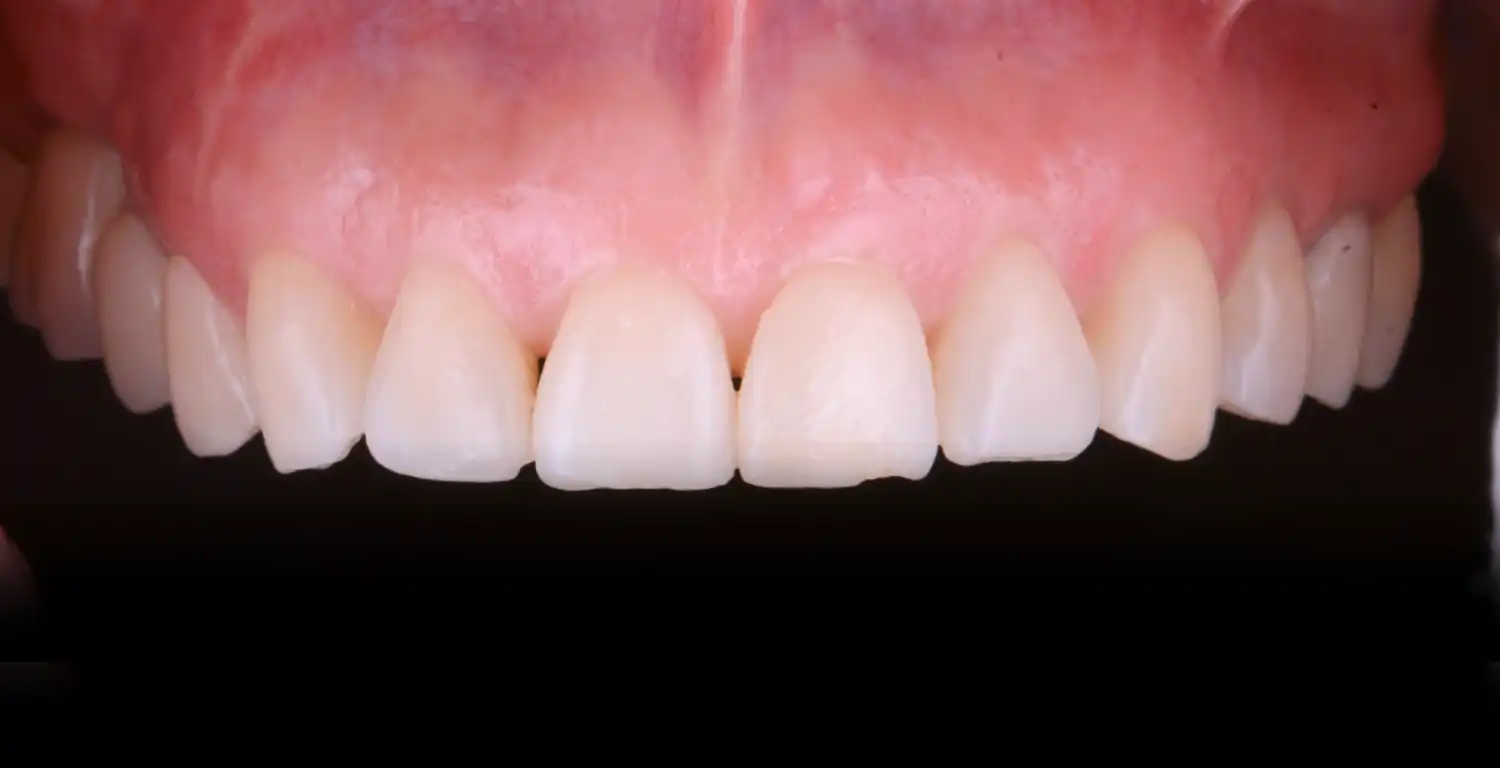 A gallery displaying close-up shots of a patient's teeth.