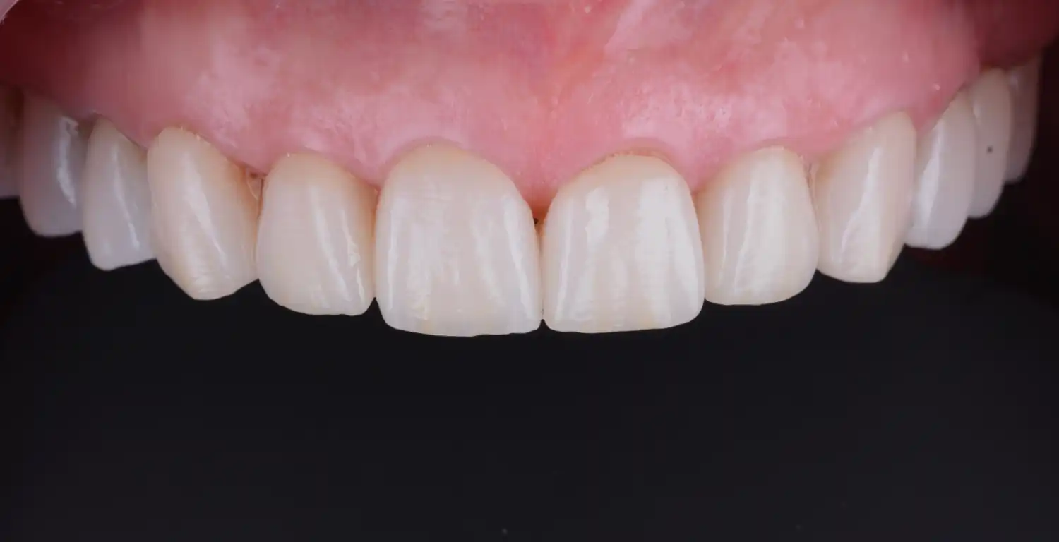 A gallery showcasing close-up views of patients' teeth.