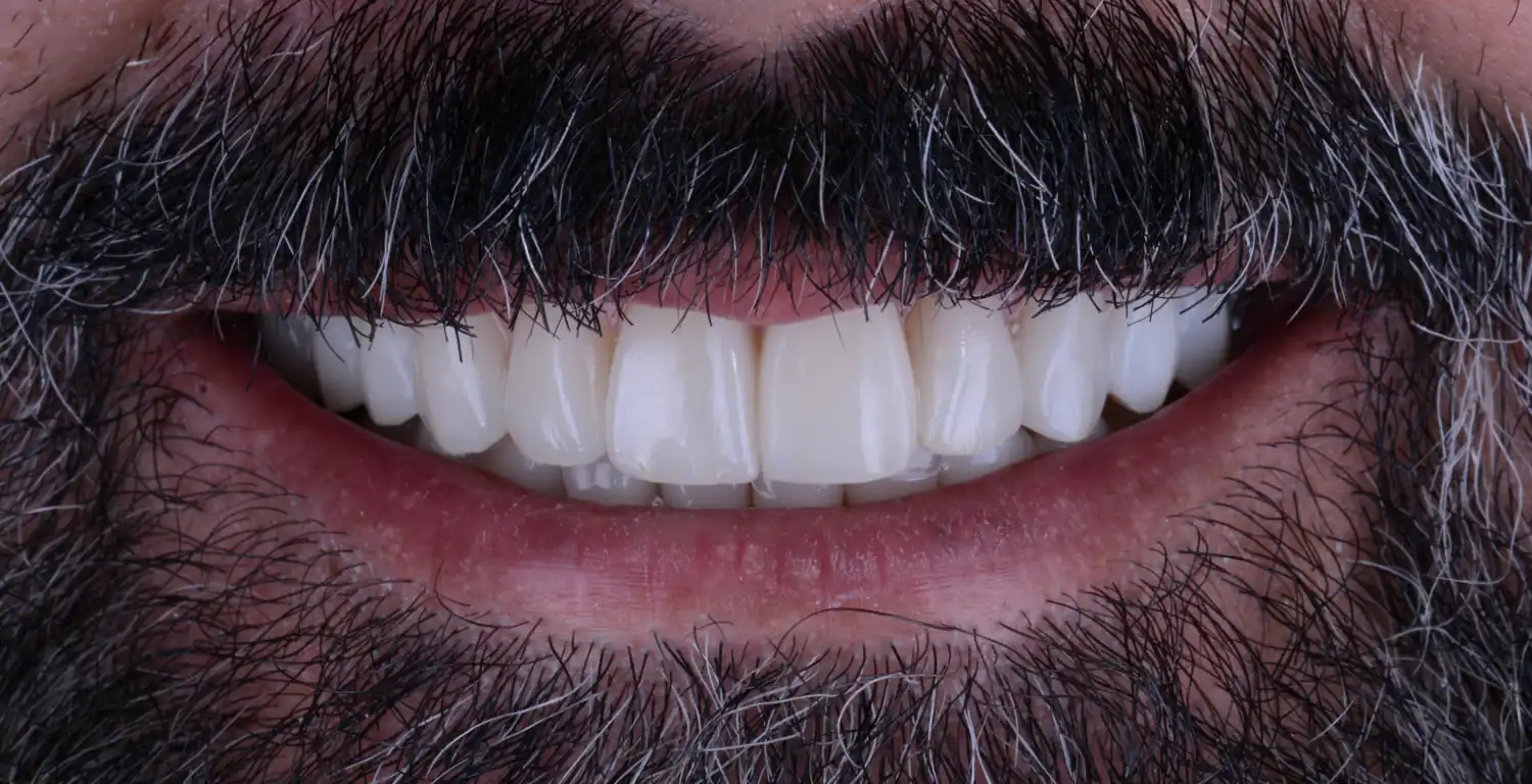 A man's smile with white teeth showcased in a gallery.