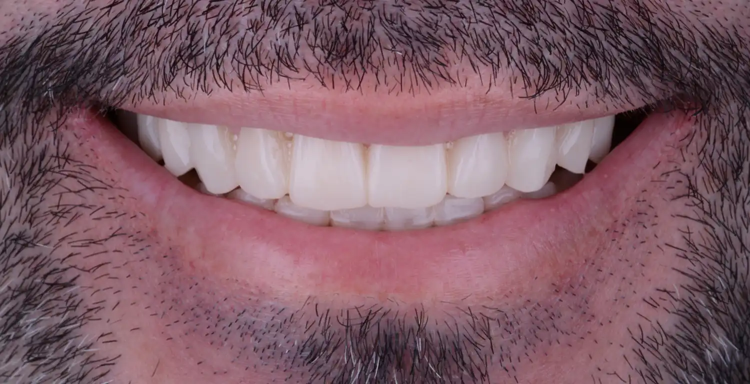 A gallery showcasing a close-up image of a man's teeth.