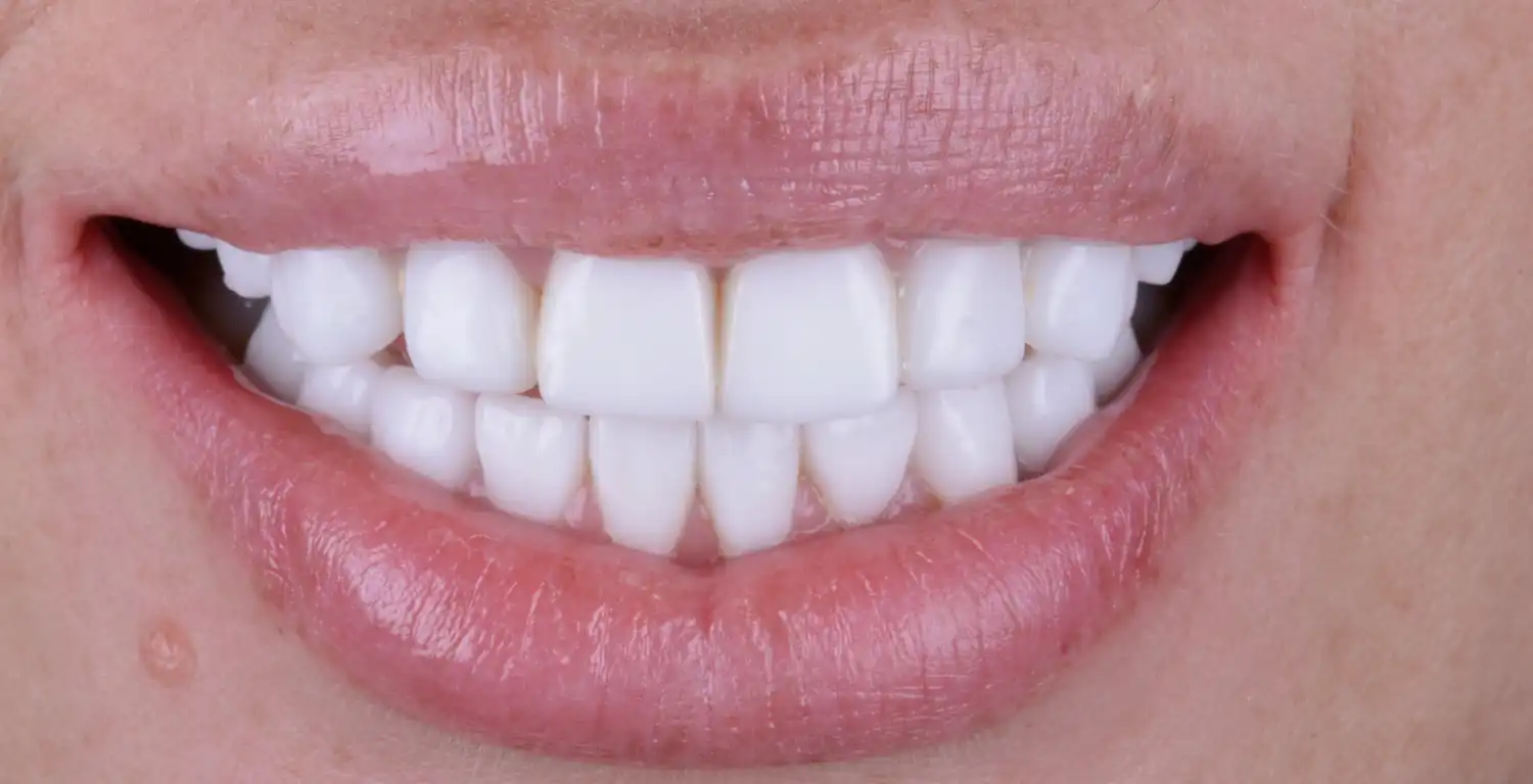 A close up of a woman's mouth with white teeth in a gallery setting.