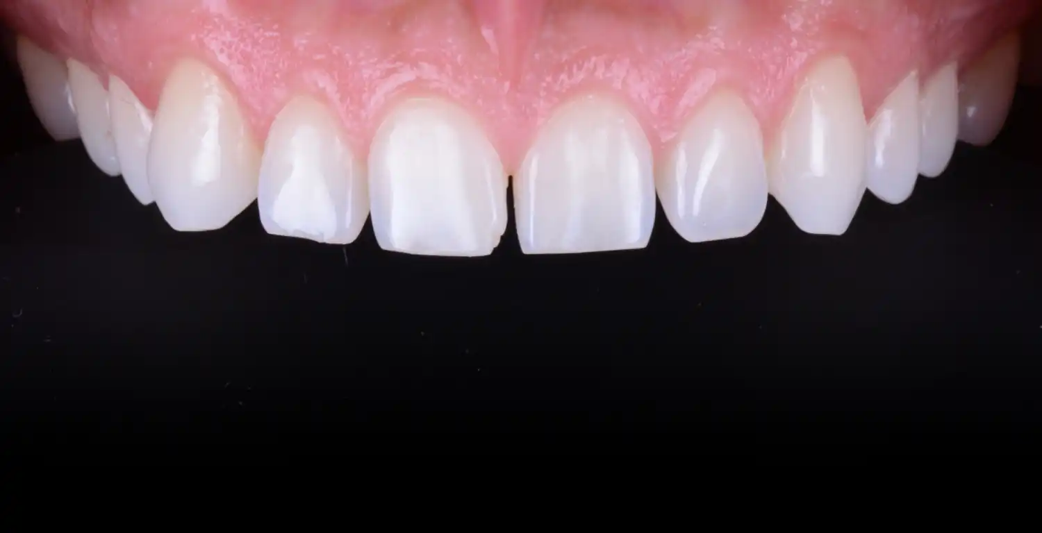 A close up gallery showcasing a patient's teeth.