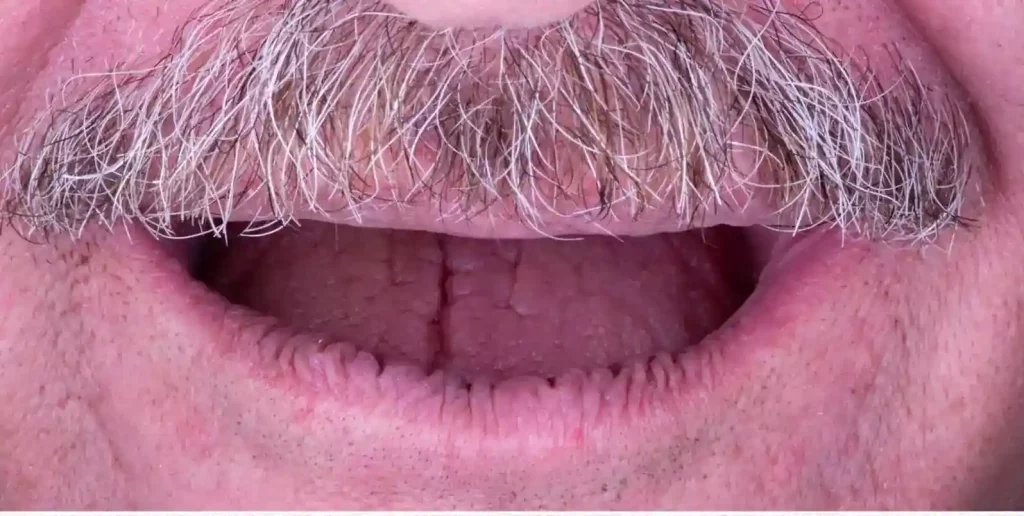 A close-up of a man's mustache.