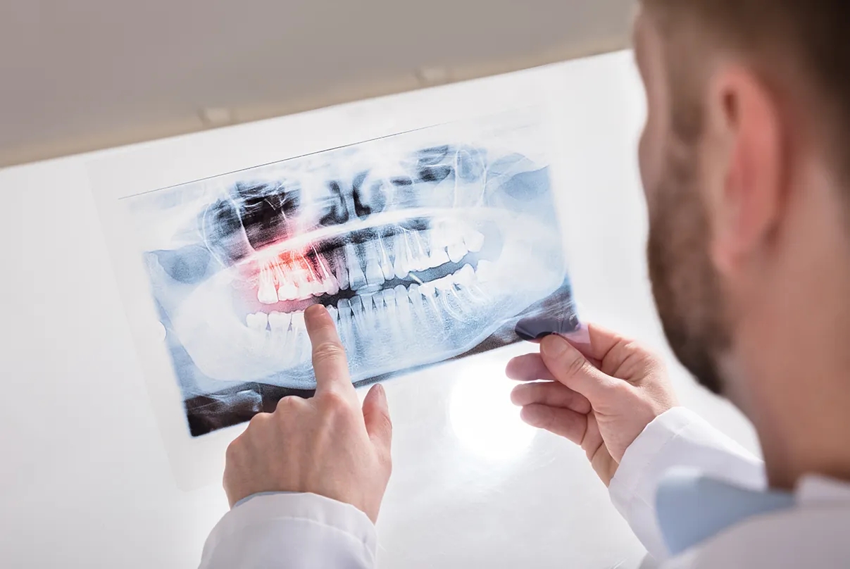 A dentist examining an x-ray of a patient's teeth during oral surgery.