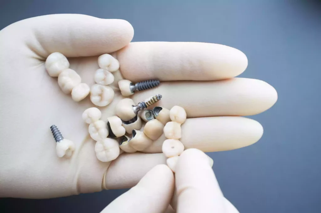A person showcases a modern dental implant solution in their hand.