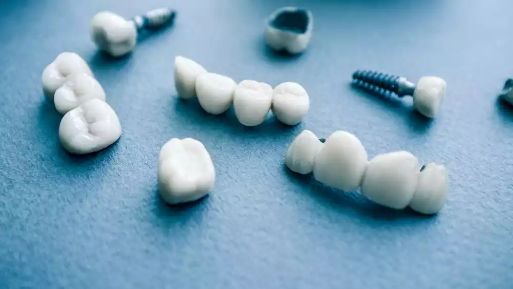 A comprehensive guide to tooth replacement options.