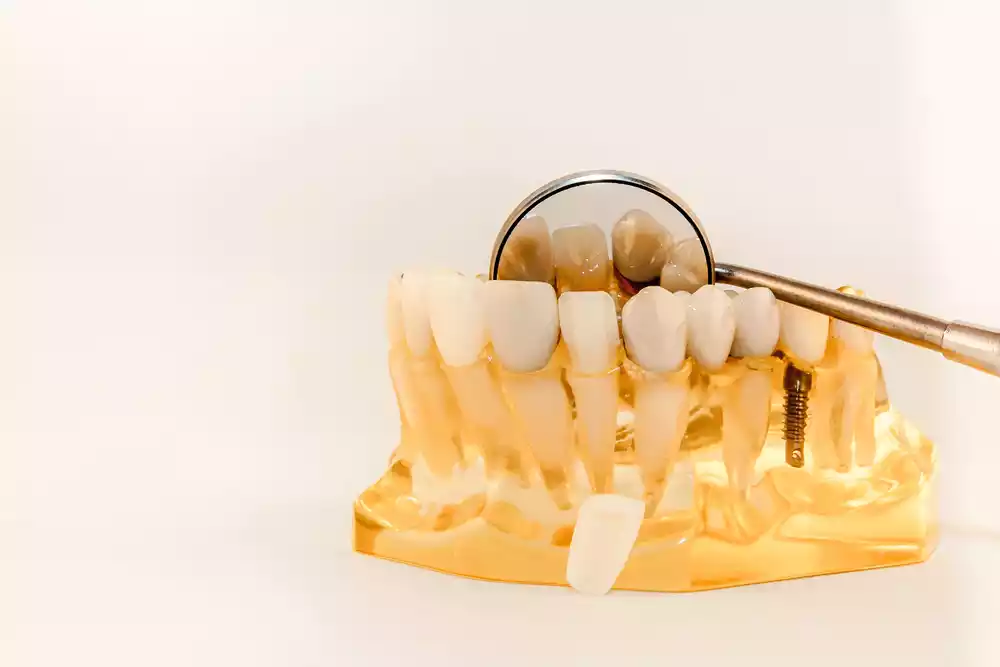 A model of a tooth with a magnifying glass can help recognize dental cavities.