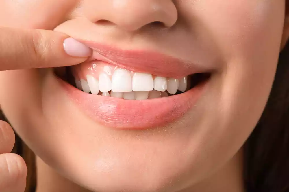 A woman is maintaining her healthy gums by putting her finger on her teeth.