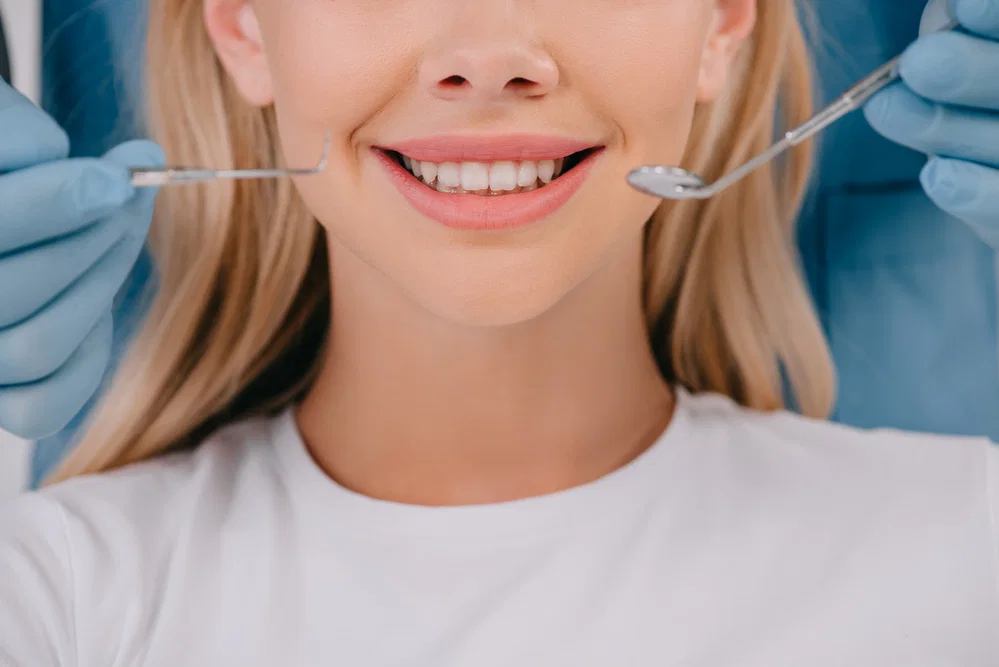 Smile design types: Exploring the best options for your perfect smile 23 smile design types 2