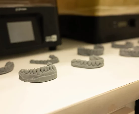 3D printed teeth showcased alongside a 3D printer, embodying Digital Smile Design.